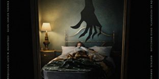 Lupus